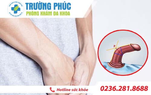 Phòng khám chỉnh hình dương vật chất lượng ở Đà Nẵng