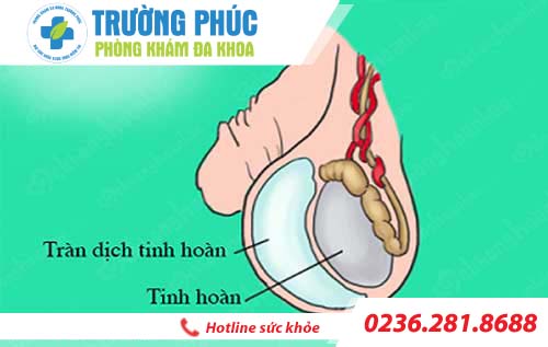 Đau tinh hoàn ở nam giới: Nguyên nhân và cách điều trị