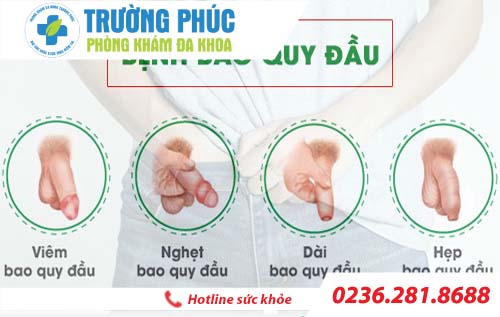 Tổng hợp bệnh về bao quy đầu dành cho nam giới