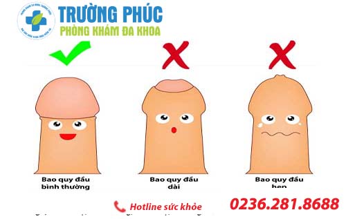 Nam giới cần cắt bao quy đầu khi nào?