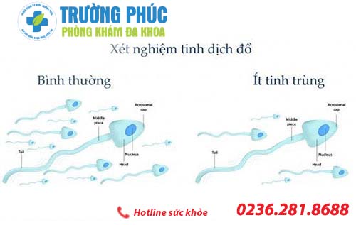 tinh trung it va phuong phap ho tro dieu tri