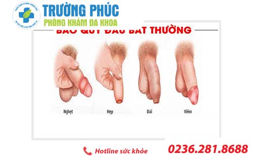 bẹnh nam khoa o nam gioi