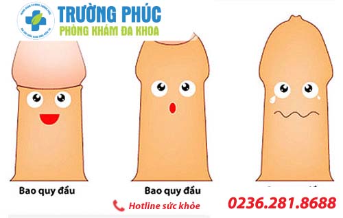 các bệnh thường gặp ở dương vật cac benh thuong gap o duong vat