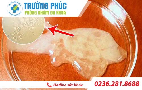 dau hieu nhạn biet tinh trung yeu
