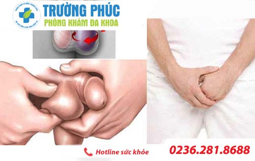 Chi phí điều trị sưng vùng bìu hết bao nhiêu?