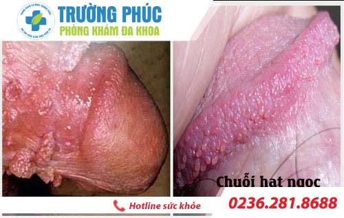 chuoi hat ngoc duong vat la gi
