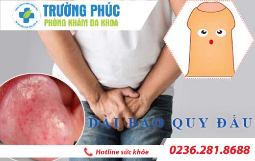 Xử lý hiệu quả triệu chứng dài bao quy đầu chỉ sau 20 phút