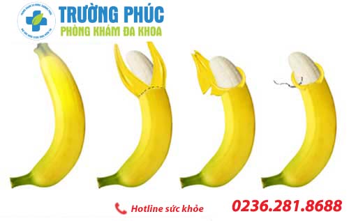 Dài bao quy đầu có nên cắt không?