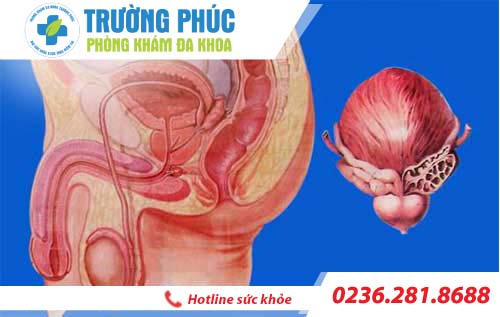 dau bao quy dau nguyen nhan do dau