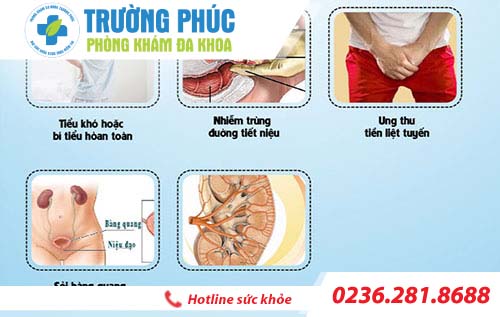 dau hieu phi dai tuyen tien liet
