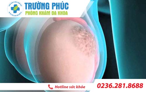 dau tinh hoan do dau