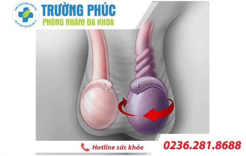 đau tinh hoàn là bệnh gì dau tinh hoan la benh gi