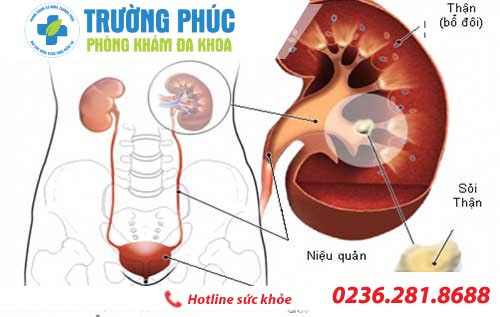 đau tinh hoàn là bệnh gì dau tinh hoan la benh gi