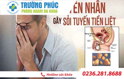 Địa chỉ trị sỏi tuyến tiền liệt đáng tin cậy