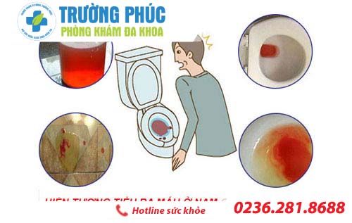 Điều trị tiểu ra máu sao cho hiệu quả?