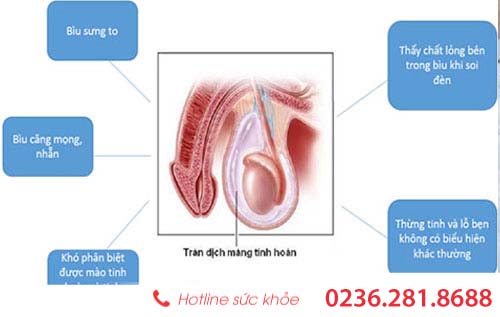 dieu tri tran dich mang tinh hoan nhu the nao?
