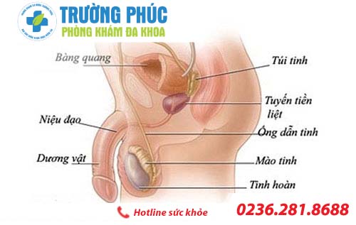 dieu tri viem tui tinh bang phuong phap nao