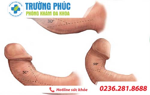 duong vat bi cong co quan he duoc khong 