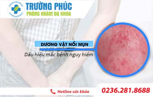 Dương vật nổi mụn là dấu hiệu của bệnh gì?