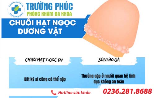 Hạt ngọc dương vật có phải là bệnh không?