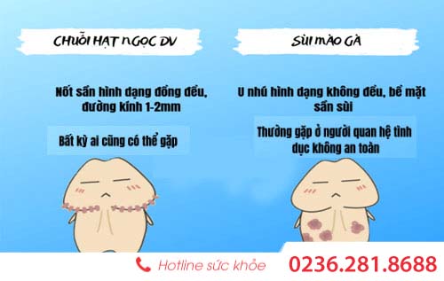 Làm sao để có cách nhìn đúng về hạt ngọc dương vật ở nam giới.