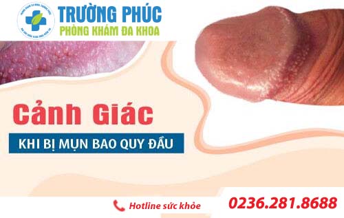 Nổi mụn ở bao quy đầu của nam giới là do đâu?