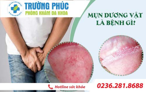 Tìm hiểu về mụn dương vật ở nam giới