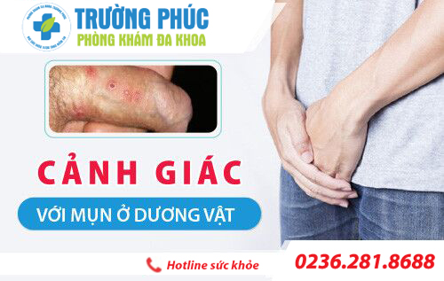 Cẩn thận với 5 căn bệnh gây nổi mụn dương vật