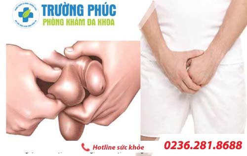 Ngứa tinh hoàn ở nam giới