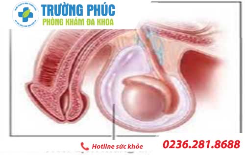 nguyen nhan gay tran dich mang tinh hoan o nam gioi