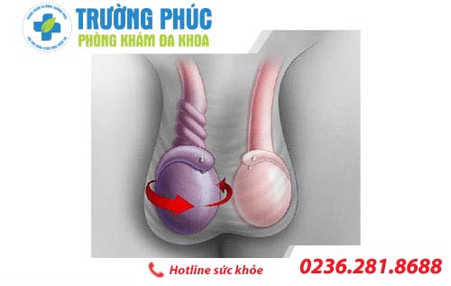 nhung benh lien quan den tinh hoan