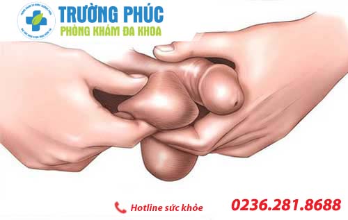 phuong phap ho tro dieu tri lech biu hien nay