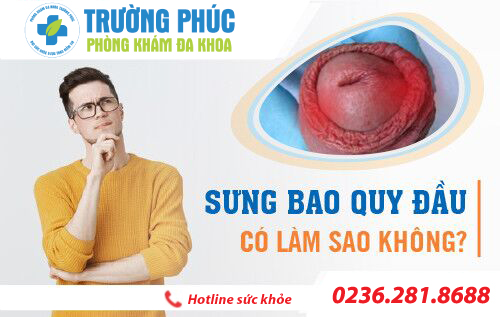 Sưng bao quy đầu cảnh báo nhiều bệnh lý nam khoa nguy hiểm