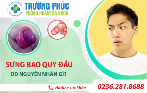Sưng bao quy đầu ở nam giới: Nguyên nhân và cách điều trị