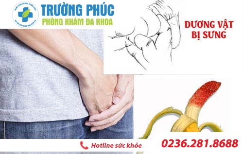Sưng dương vật nguy hiểm như thế nào đối với đàn ông?
