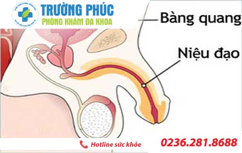 tim hieu benh viem nieu dao o nam gioi