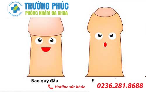 tim hieu benh viem nieu dao o nam gioi