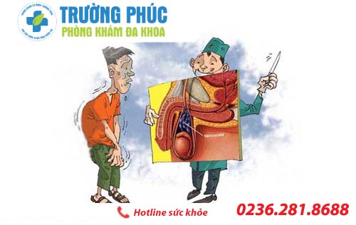 Tìm hiểu chi phí tiểu phẫu giãn tĩnh mạch thừng tinh