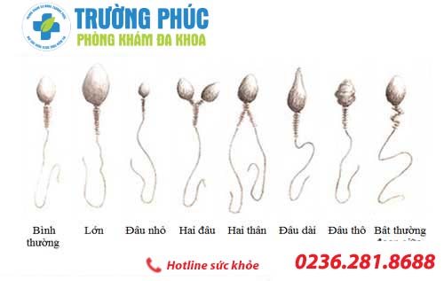 tim hieu tinh trung di dang o nam gioi 