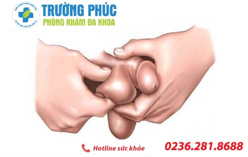 Tìm hiểu về bệnh thòng tinh hoàn ở nam giới