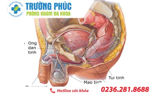 kien thuc ve benh viem mao tinh hoan