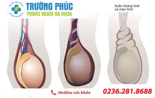 kien thuc ve benh viem tinh hoan o nam gioi