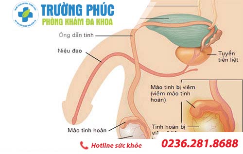 kien thuc ve benh viem tinh hoan o nam gioi