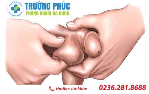 Tinh hoàn to có ảnh hưởng như thế nào?