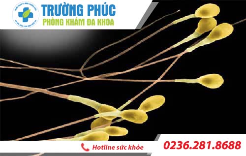 Tinh trùng có màu vàng là bệnh gì?