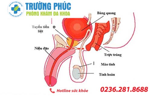 Triệu chứng bệnh viêm niệu đạo không thể bỏ qua