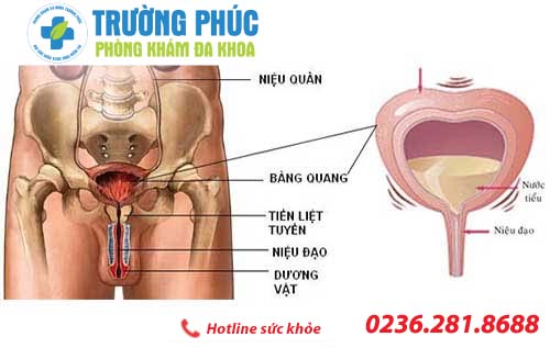 4 Điều đặc biệt lưu ý khi mắc bệnh viêm bàng quang