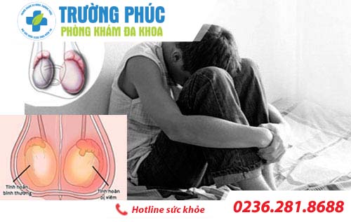 Viêm tinh hoàn: Nguyên nhân và phương pháp điều trị